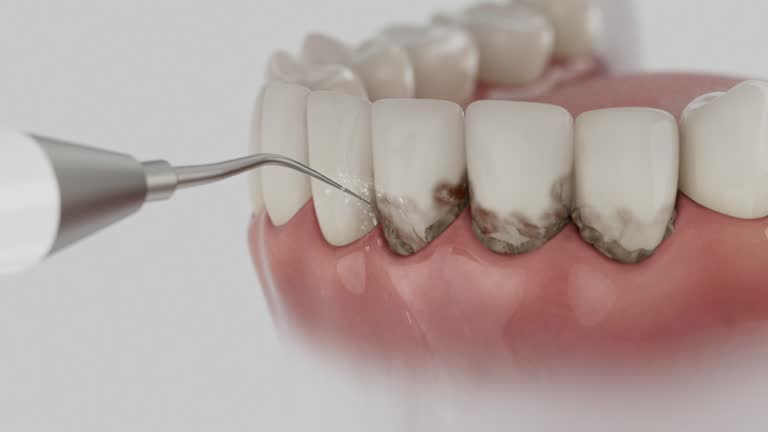 Trusted Wisdom Tooth Removal service in Stafford Courthouse, VA - Dentist Open Now